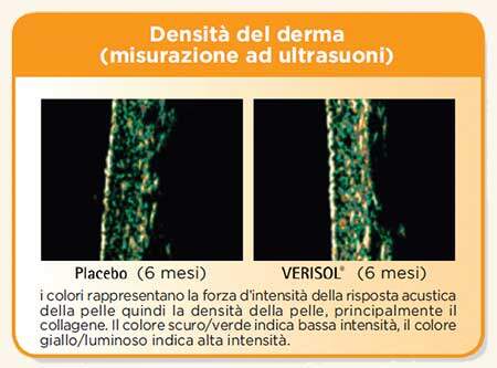 GE.FO. nutrition Srl: densità del derma (misurazione ad ultrasuoni)