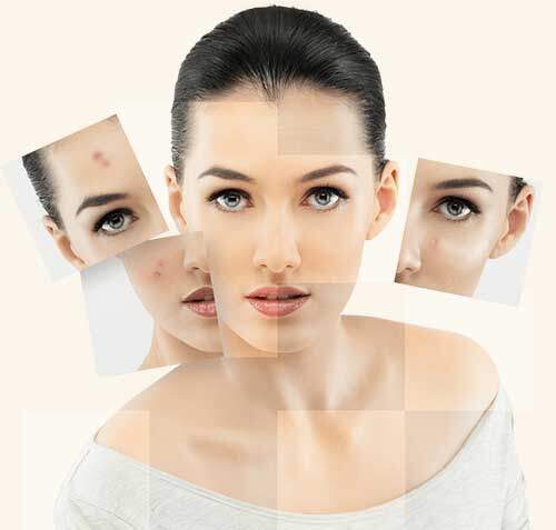 Skin Colplus Crema Schiarente è indicata per nutrire la pelle e per ridurre la pigmentazione delle macchie cutanee