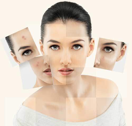 Skin Colplus Crema Schiarente è indicata per nutrire la pelle e per ridurre la pigmentazione delle macchie cutanee Skin Colplus Crema Schiarente è indicata per nutrire la pelle e per ridurre la pigmentazione delle macchie cutanee
